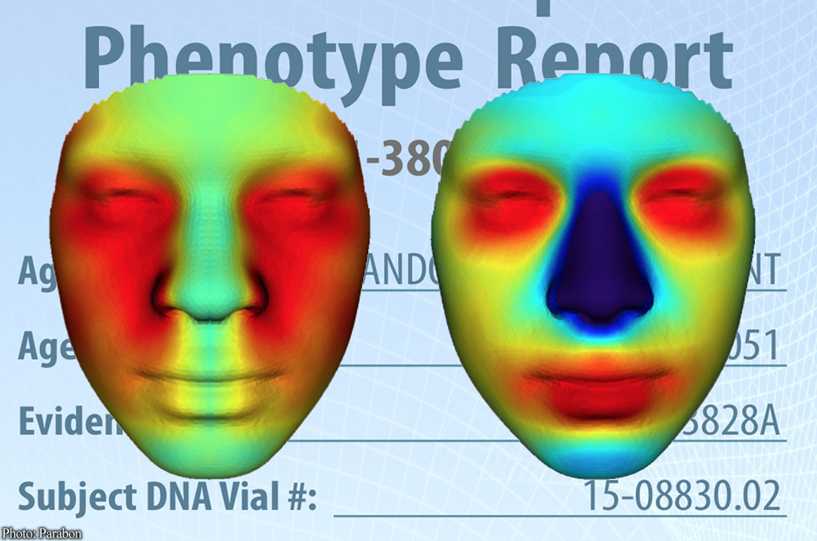 Forensic Dna Phenotyping Aclu